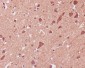 Anti-p38 MAPK MAPK14 Rabbit Monoclonal Antibody